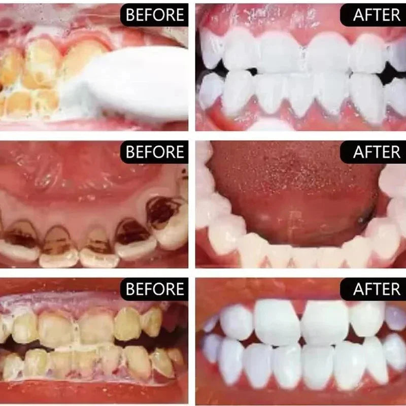 5 Days Teeth Whitening Powder Remove Plaque Stains Dental Care Products